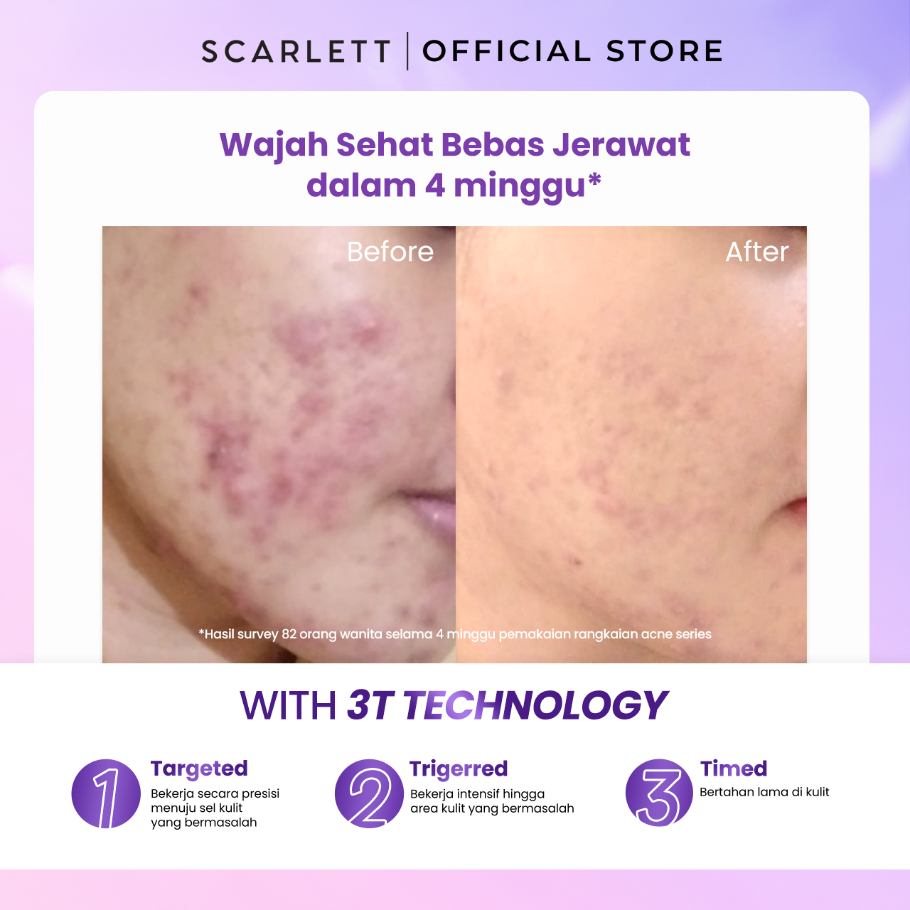 Scarlett Basic Skincare Set (Bebas Jerawat)